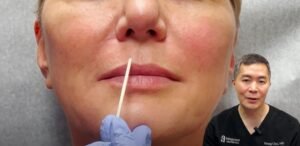 How to Make Lips Fuller Without Injections